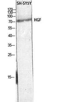 HGF rabbit pAb Antibody
