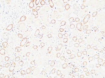 HGF rabbit pAb Antibody