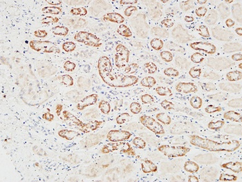 HGF rabbit pAb Antibody