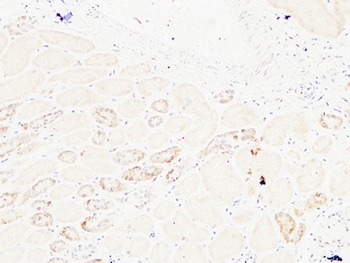 HGF rabbit pAb Antibody
