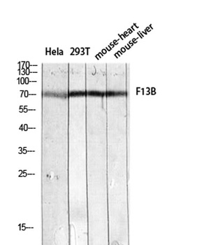 Factor XIII B rabbit pAb Antibody