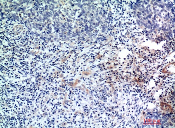 EDA rabbit pAb Antibody