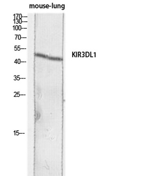 CD158e rabbit pAb Antibody
