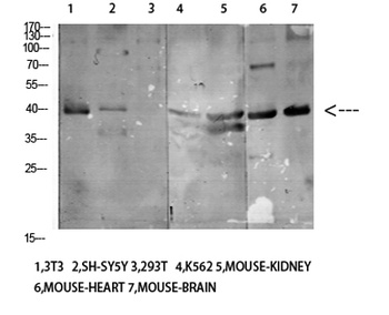 CD158e rabbit pAb Antibody