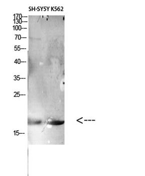 CD306 rabbit pAb Antibody