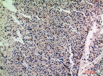 IL-1F10 rabbit pAb Antibody
