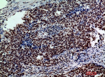 Galactosidase β rabbit pAb Antibody