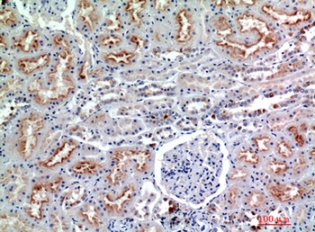 CD56 rabbit pAb Antibody