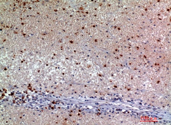 Synuclein-α rabbit pAb Antibody