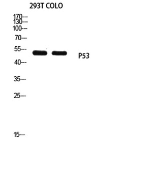 p53 (Mono Methyl Lys370) rabbit pAb Antibody