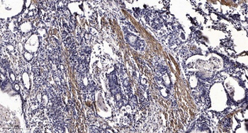 RIP140 (Acetyl Lys158) rabbit pAb Antibody
