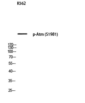Atm (phospho Ser1981) rabbit pAb Antibody