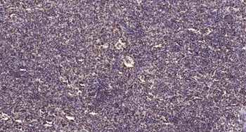 Atm (phospho Ser1981) rabbit pAb Antibody