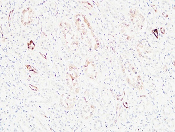 K-Ras rabbit pAb Antibody