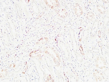 K-Ras rabbit pAb Antibody