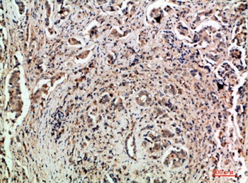 TLE1/2/3/4 rabbit pAb Antibody