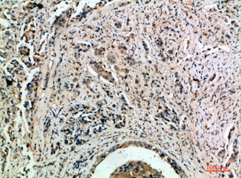 TLE1/2/3/4 rabbit pAb Antibody