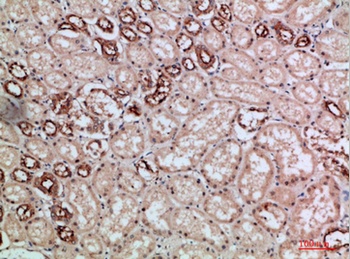 Villin rabbit pAb Antibody