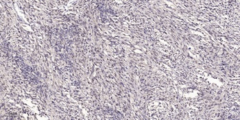 IgM Chain C rabbit pAb Antibody
