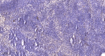 PTH-rP rabbit pAb Antibody