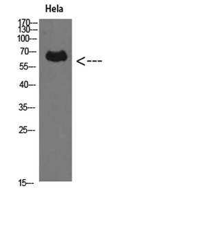 Perforin 1 rabbit pAb Antibody
