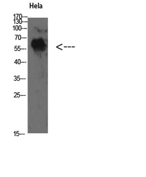 TyrRS rabbit pAb Antibody