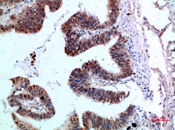 TyrRS rabbit pAb Antibody