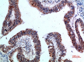 TyrRS rabbit pAb Antibody