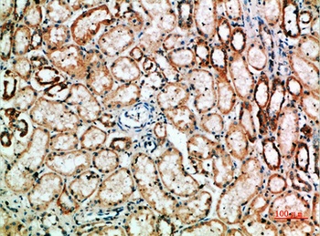 TyrRS rabbit pAb Antibody