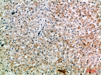 SPOP rabbit pAb Antibody