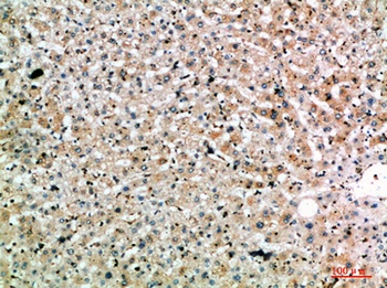 SPOP rabbit pAb Antibody