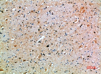 SPOP rabbit pAb Antibody