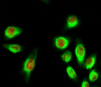 E2F-1 rabbit pAb Antibody