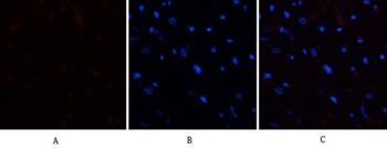 E2F-1 rabbit pAb Antibody