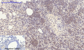 E2F-1 rabbit pAb Antibody