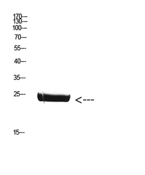 CSH1 rabbit pAb Antibody