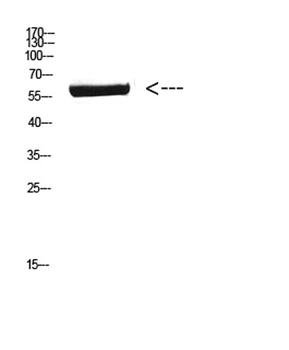 CYP26B1 rabbit pAb Antibody