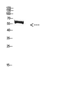 FBXO7 rabbit pAb Antibody