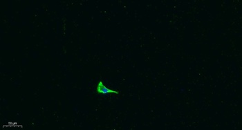 COL17A1 rabbit pAb Antibody