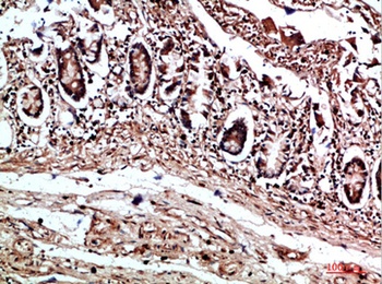 COL17A1 rabbit pAb Antibody