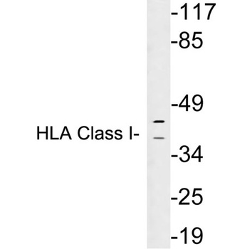HLA Class I rabbit pAb Antibody