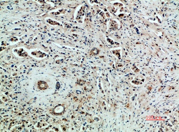 Flk-1/VEGFR2 rabbit pAb Antibody
