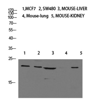 Calcitonin rabbit pAb Antibody