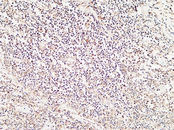 Calcitonin rabbit pAb Antibody