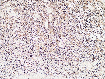 Calcitonin rabbit pAb Antibody