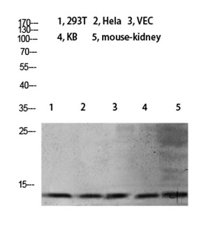 Histone H4 (Mono Methyl Lys21) rabbit pAb Antibody