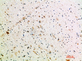 NT-3 rabbit pAb Antibody
