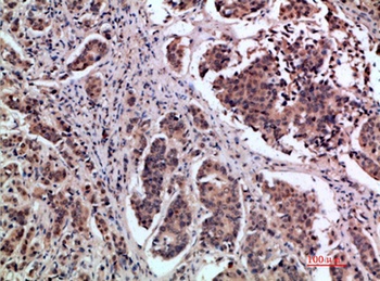 pS2 rabbit pAb Antibody