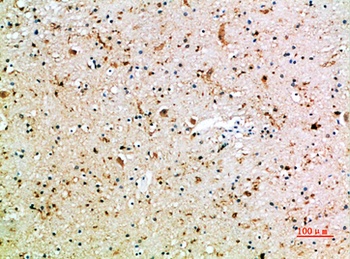 CD16 rabbit pAb Antibody