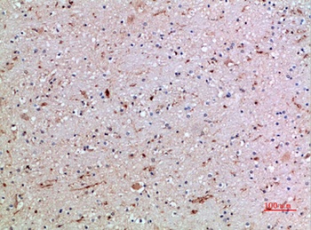 CD16 rabbit pAb Antibody
